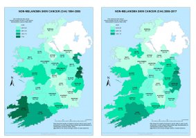 Non-melanoma skin 1994-2005 & 2006-2017 annual average